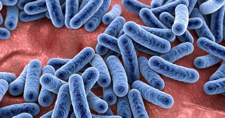 Schleimschicht im Darm